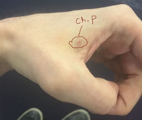 I got a computer chip implanted into my hand. Here's 